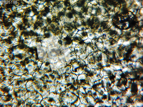 Image of Courgettes micrograph