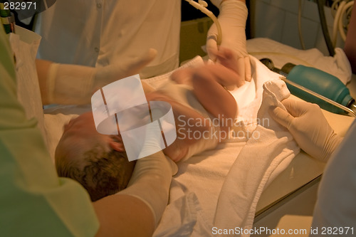 Image of Newborn resuscitation