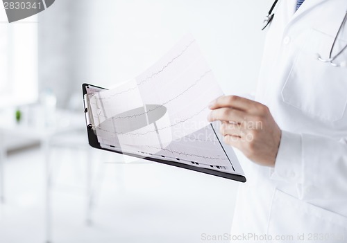 Image of male doctor hands holding cardiogram