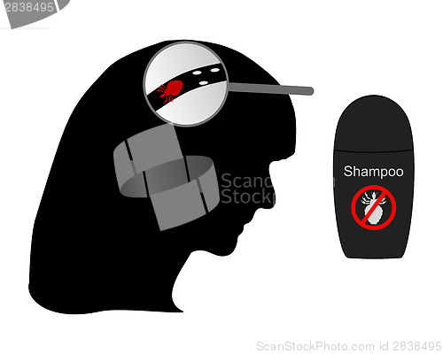 Image of Head of woman, louse, nit and lice shampoo