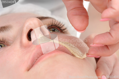 Image of mustache depilation