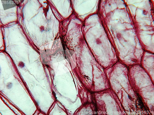 Image of Onion epidermus micrograph