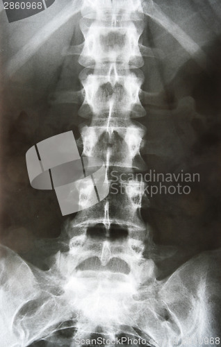 Image of X-ray
