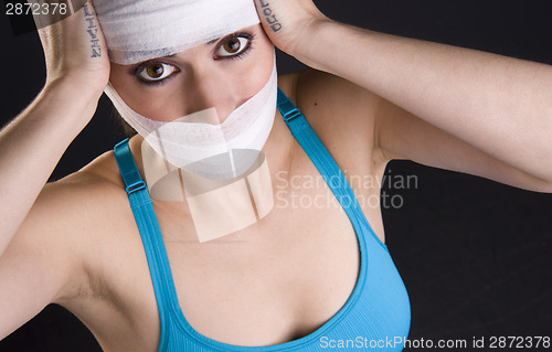 Image of Big Brown Eyed Woman With Treated Head Injury