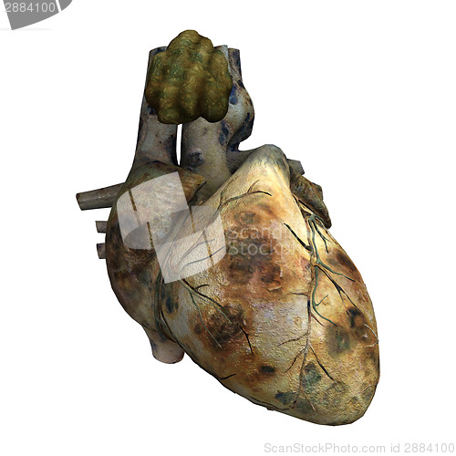 Image of Human Heart