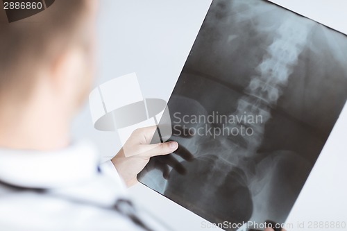 Image of doctor holding x-ray or roentgen image