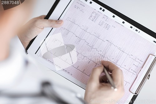 Image of male doctor hands with cardiogram