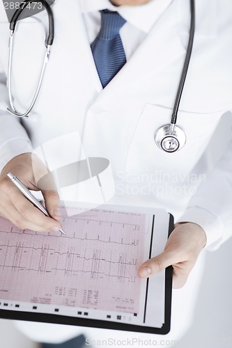 Image of male doctor hands with cardiogram