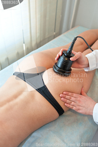 Image of procedure