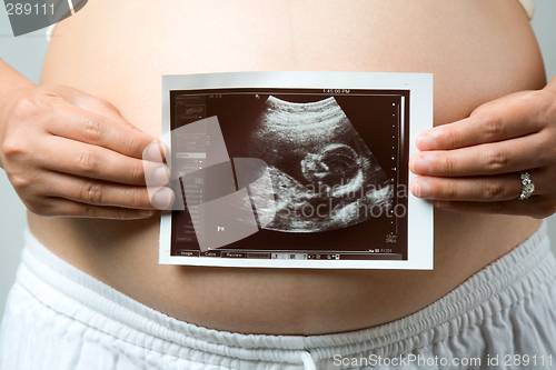 Image of Pregnant woman