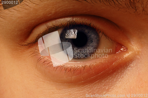 Image of Close-up of eyeball