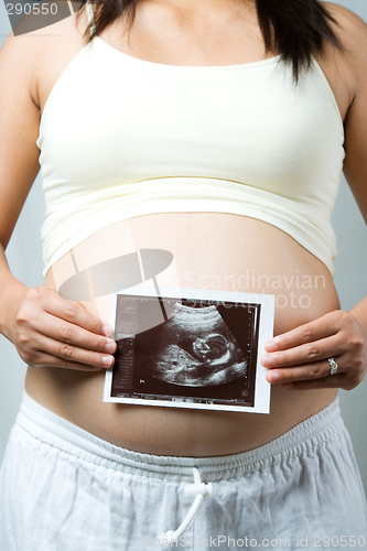 Image of Pregnant woman