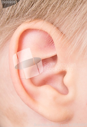 Image of child ear