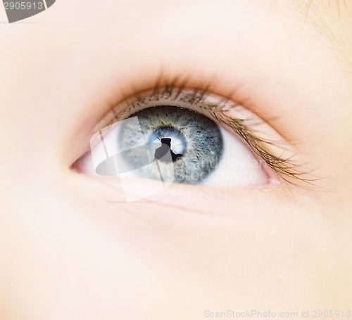 Image of baby eye 