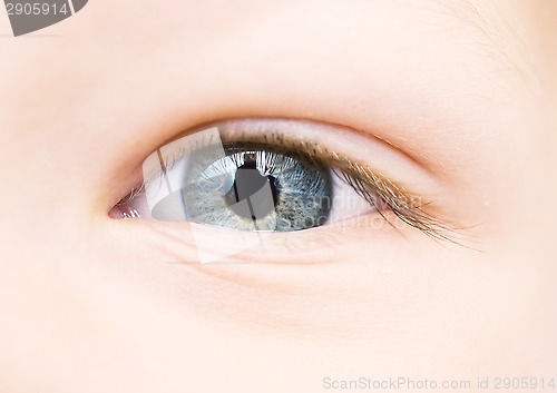 Image of baby eye