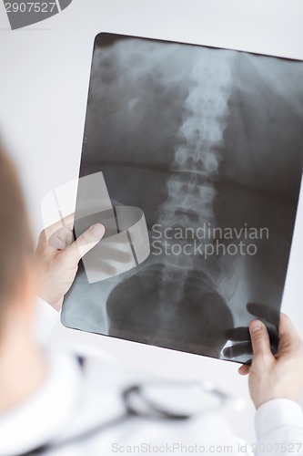 Image of doctor holding x-ray or roentgen image