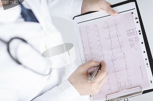 Image of male doctor hands with cardiogram