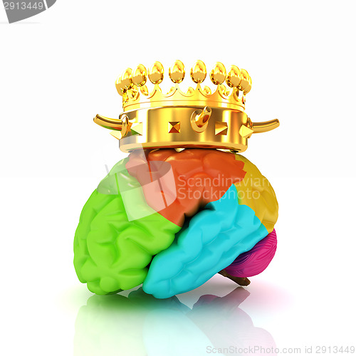 Image of Gold Crown on the brain