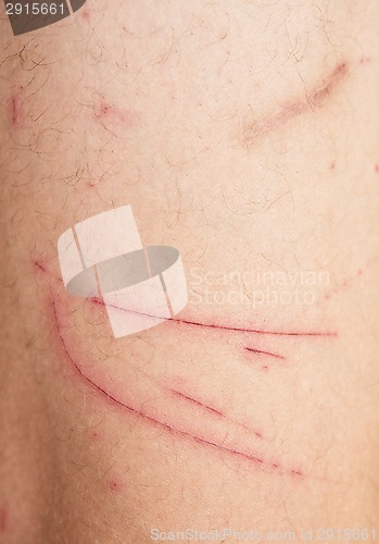 Image of wound