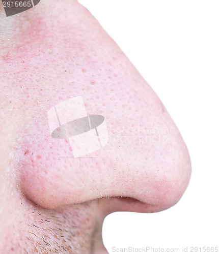 Image of nose