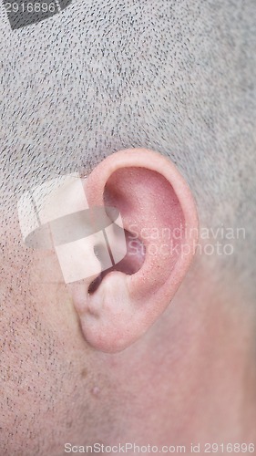 Image of human ear