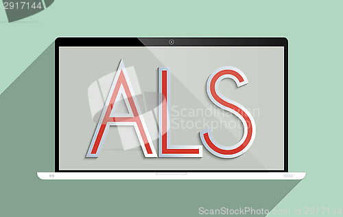 Image of ALS Amyotrophic lateral sclerosis