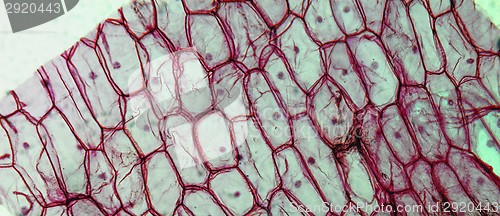 Image of Onion epidermus micrograph