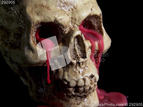 Image of Bleeding Human Skull