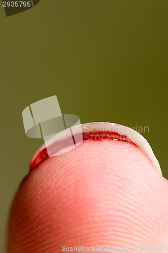 Image of Bloody thumb