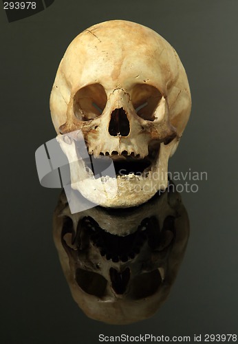 Image of skull