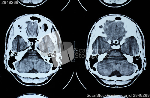 Image of CT and MRI of the skull