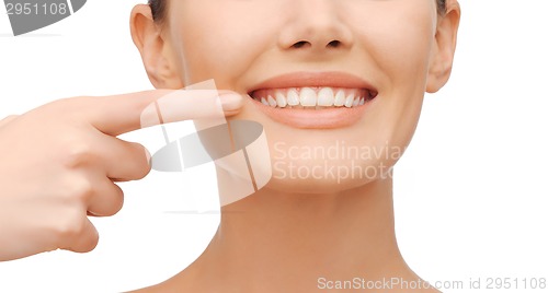 Image of beautiful woman pointing to teeth