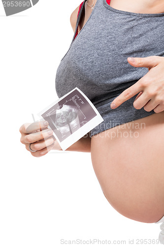 Image of Pregnant woman displaying a prenatal ultrasound