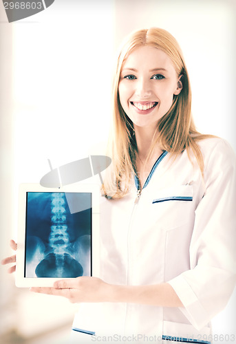Image of female doctor with x-ray on tablet pc