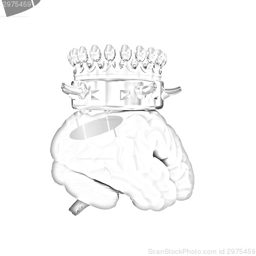 Image of Gold Crown on the brain