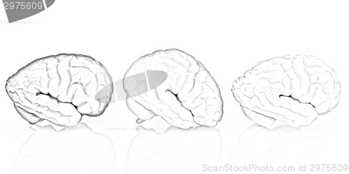 Image of Human brains