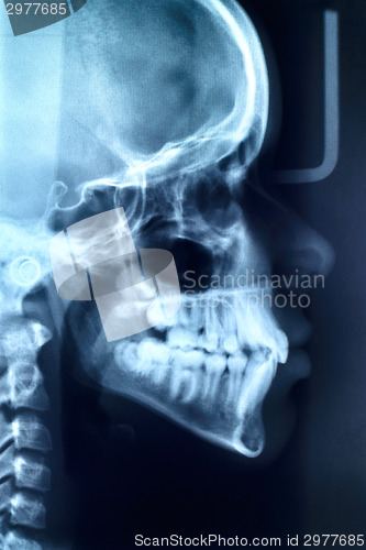 Image of Glowing and radiant MRI scan