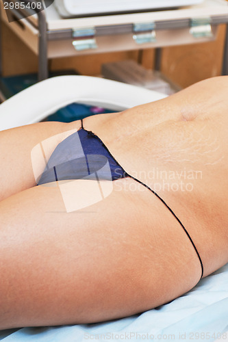 Image of skin stretch