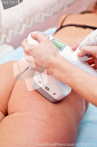 Image of procedure