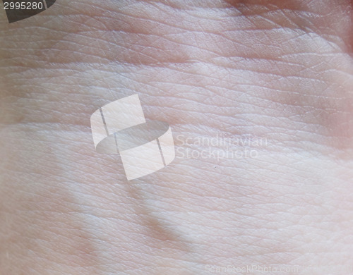 Image of human skin