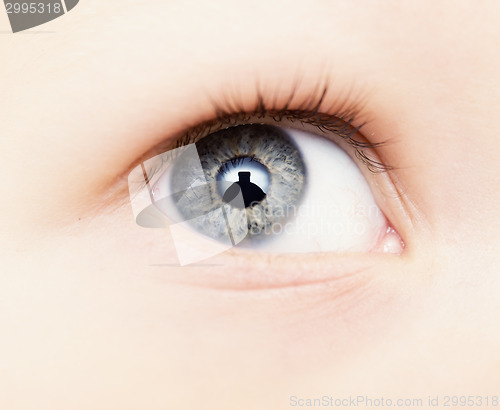 Image of baby eye