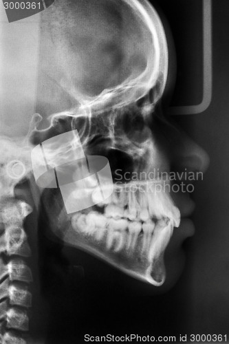 Image of Glowing and radiant MRI scan