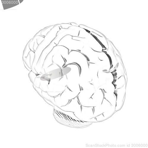 Image of Metall human brain
