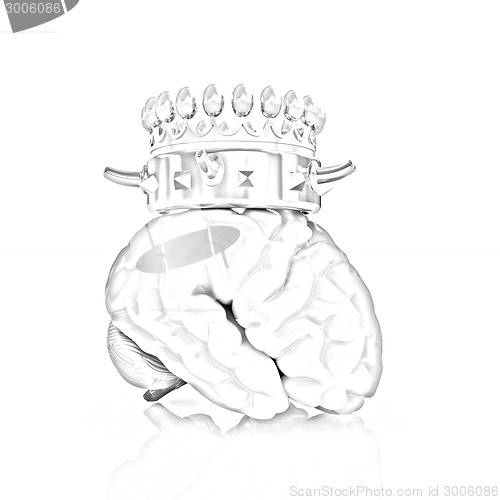 Image of Gold Crown on the brain