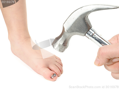 Image of Someone holding a hammer over a child's foot with blue hallux na