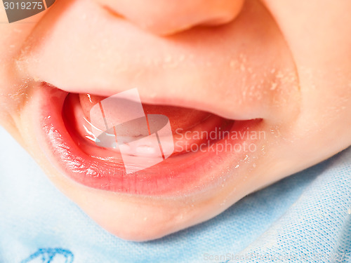 Image of Baby boy showing first teeth with mouth wide open