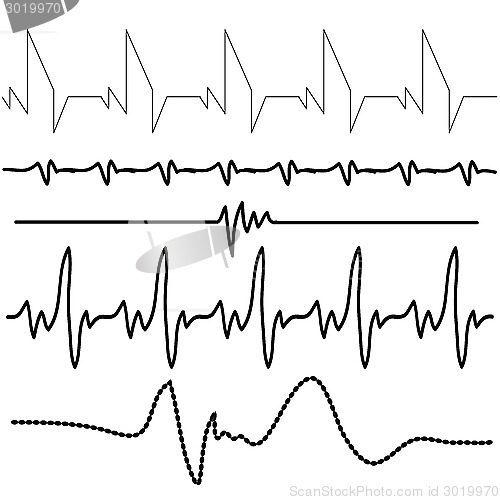 Image of electrocardiogram