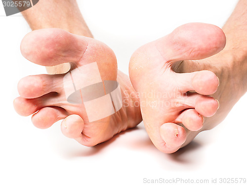 Image of Male person spreading toes towards white background