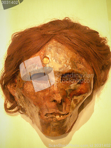 Image of Preserved Head With Trepanning Hole