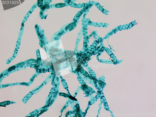 Image of Spirogyra micrograph